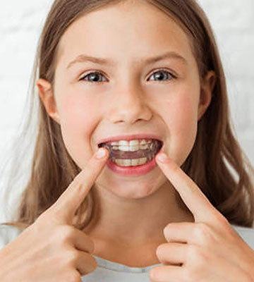 img-chawlaorthodontics-treatment-invisalign-kid-01