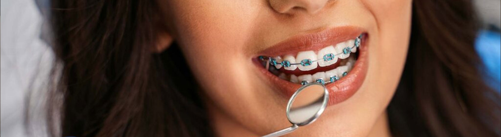 img-homechawlaorthodontics-orthodontics-header