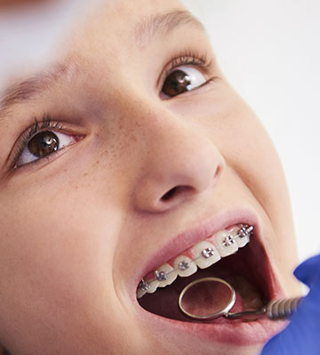 img--treatment-braces-kid-01