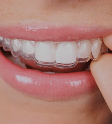 img-chawlaorthodontics-reatainer-whychoose