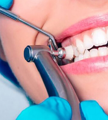 img-chawlaorthodontics-routinedentalcleaning-03