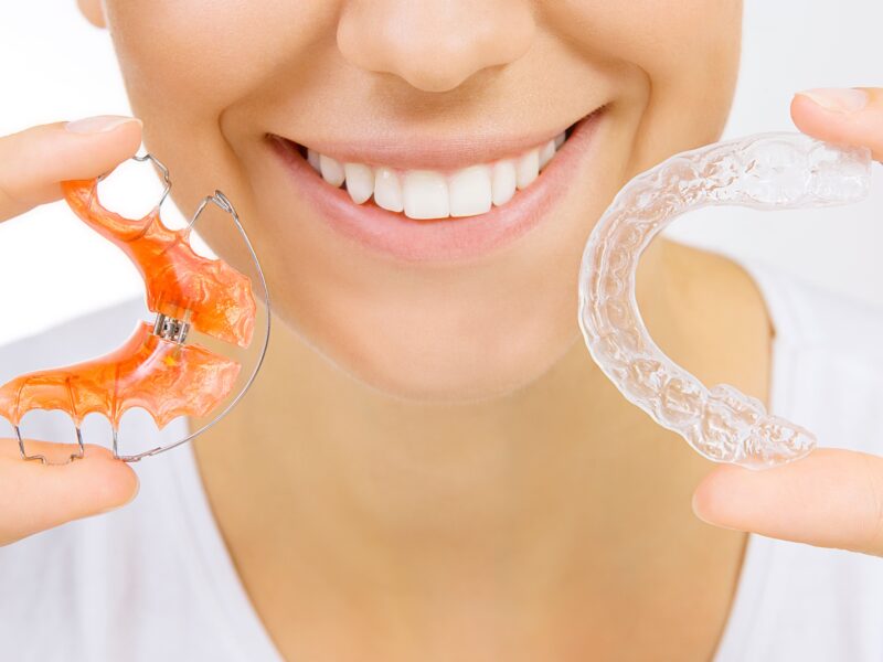 braces orthodontist in Villa Park IL
