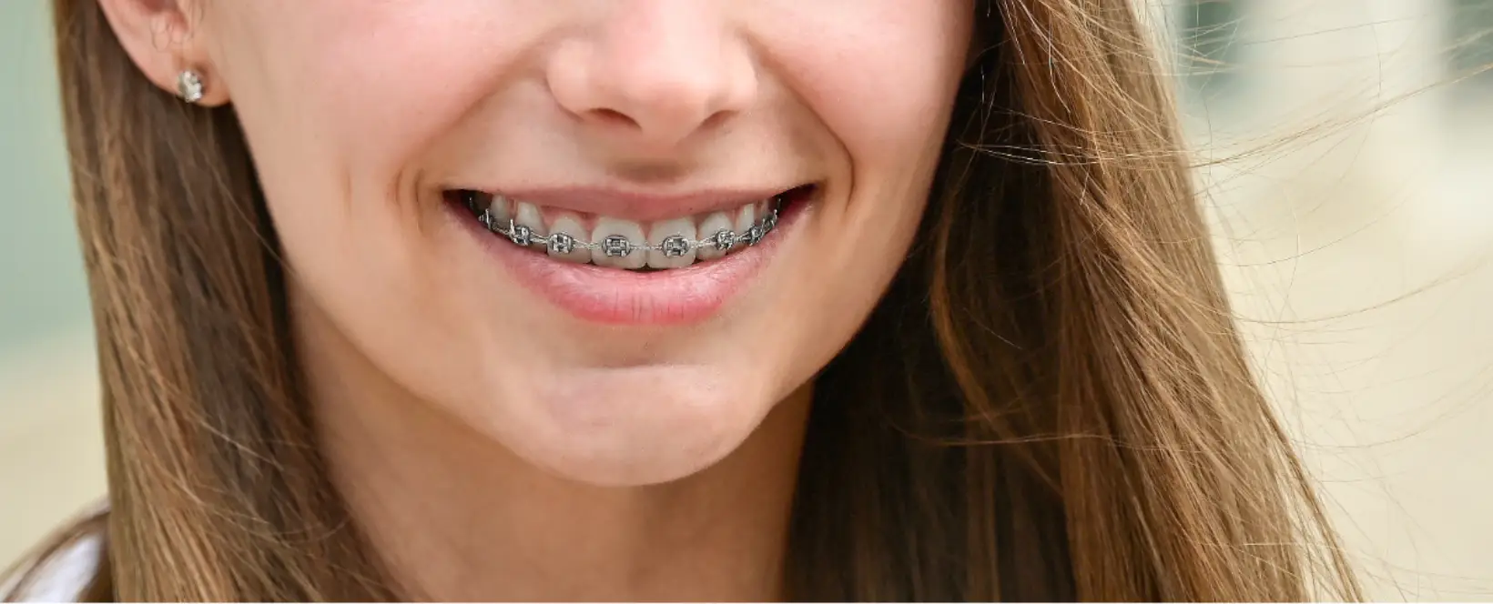 img-homechawlaorthodontics-orthodontics-header